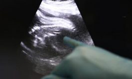 featured 2164041 265x160