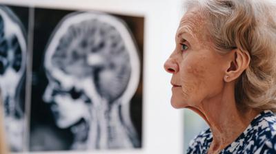 Giornata salute donne, Sin 'prendetevi cura anche della salute neurologica'