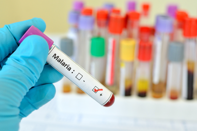Sanità: Giornata malaria, 263 mln i casi nel mondo nel 2023, in Italia 798 tutti importati