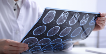 featured 2229977 364x187