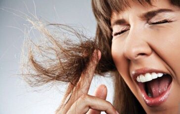 Doppie punte: da cosa dipendono e come rimediare