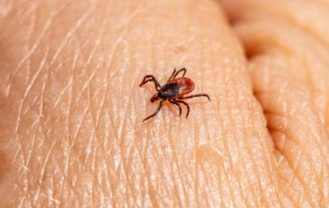 castor bean tick 8218542 1280 364x230