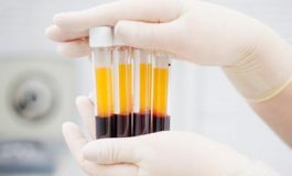 featured 2308451 265x160