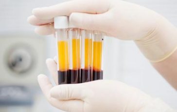 featured 2308451 364x230