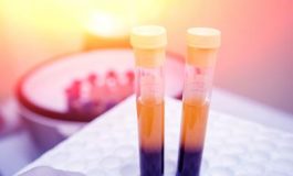 featured 2308453 265x160