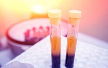 featured 2308453 364x230