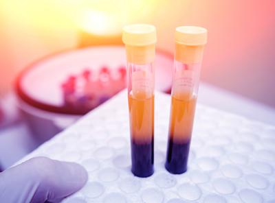Farmaci, Sava (Sif Magazine): "In plasmaderivati attenzione particolare a sicurezza"