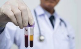 featured 2308621 265x160