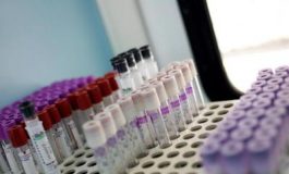 featured 2332065 265x160