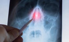 featured 2352160 265x160