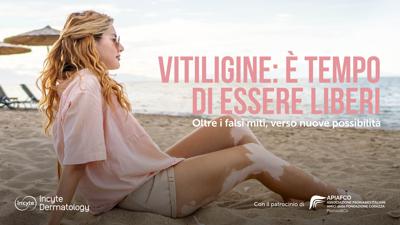 Salute, Giornata vitiligine: al via campagna 'Oltre falsi miti verso nuove possibilit&agrave;'