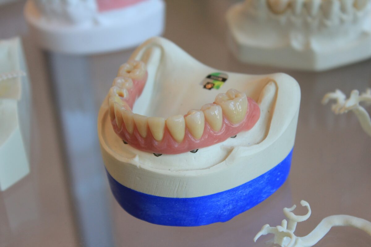 Cura dei denti: quali differenze tra dentiera fissa e mobile?