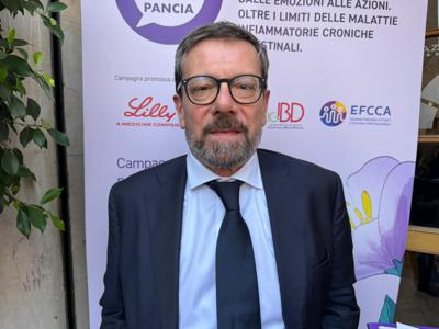 Armuzzi (Humanitas): "In Italia 260mila persone con Mici, diagnosi precoce fondamentale"