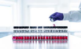 featured 2502157 265x160