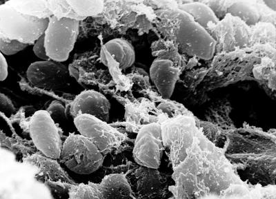 Ricerca, Scorrano (Tor Vergata): "Dal Dna di 1.313 antenati l'evoluzione delle malattie infettive"