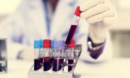 featured 2567750 265x160