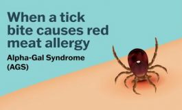 featured 2571614 265x160