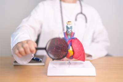 Fibrosi cistica, Aifa rinnova e amplia anche a bimbi rimborsabilità trattamenti