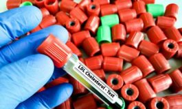 featured 2650594 265x160