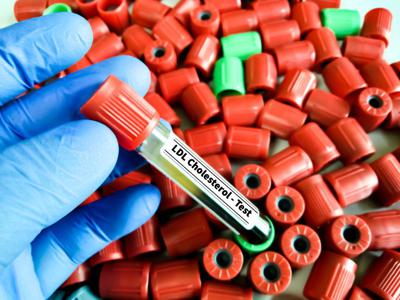 Colesterolo Ldl, per abbassalo in sviluppo nuova terapia con tripla combinazione 