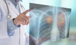 featured 2742641 265x160