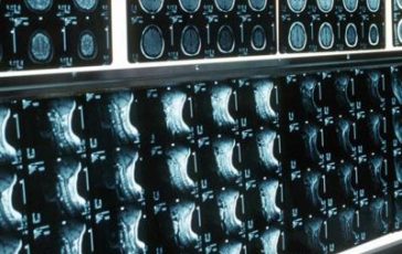 featured 2770686 364x230