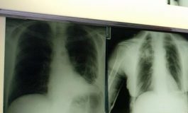 featured 2774105 265x160