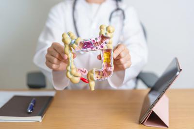 Cancro al colon, microbioma può predirne rischio e guidare diagnosi precoce