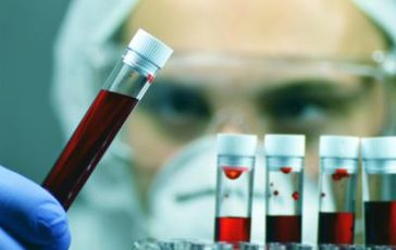 featured 2807454 364x230