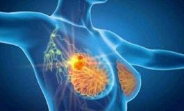 featured 2811455 265x160