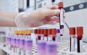 featured 2820230 364x230