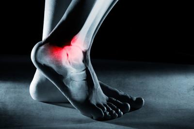 Ossa fragili dei calciatori, ecco perché post ritiro tanti soffrono di osteoartrite