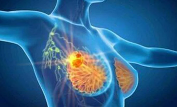 featured 2832372 364x221