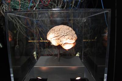 Medicina, neurologi: "L'innovazione pu&ograve; cambiare la storia di molte malattie ma serve equit&agrave;"