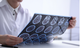 featured 2908189 265x160