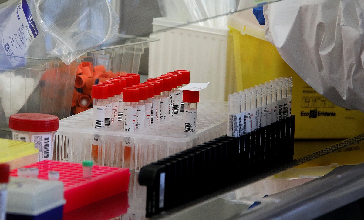 Allarme sanitario: trovato nelle fogne il virus selvaggio della poliomielite