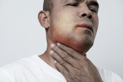 Angioedema ereditario, ok Ue a prima terapia preventiva mirata all'Rna