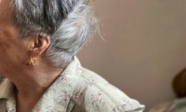 Quando le McSC bloccate interrompono il pigmento: ecco la sorpresa dello studio americano