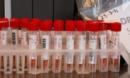 mcv alto cosa significa quando preoccuparsi