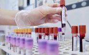 allarme oncologi 50 trial in europa in 10 anni mentre cina accelera 2