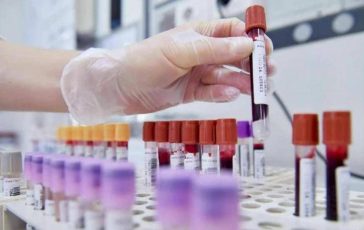 Allarme oncologi 50 trial in Europa in 10 anni mentre Cina accelera 364x230