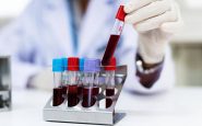 aviaria cose il virus h9n2 come si trasmette e i rischi per luomo 2
