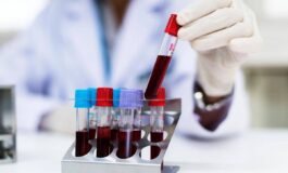 Aviaria cose il virus H9N2 come si trasmette e i rischi per luomo 265x160