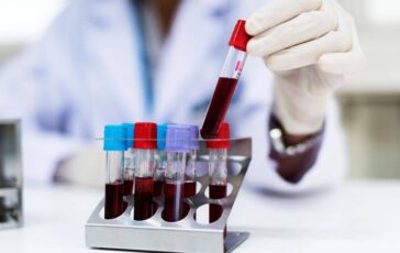 Aviaria cose il virus H9N2 come si trasmette e i rischi per luomo 364x230