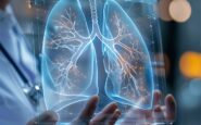 cancro aggressivo al polmone con mix di farmaci biologici raddoppia efficacia senza chemio 2