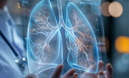 Cancro aggressivo al polmone con mix di farmaci biologici raddoppia efficacia senza chemio 265x160