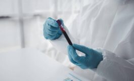 Epatite A in forte crescita in Italia Lazio Campania e Puglia le regioni con piu casi 265x160