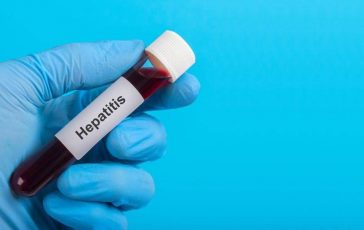 Igienista Triassi Focoloaio epatite A punta iceberg 364x230