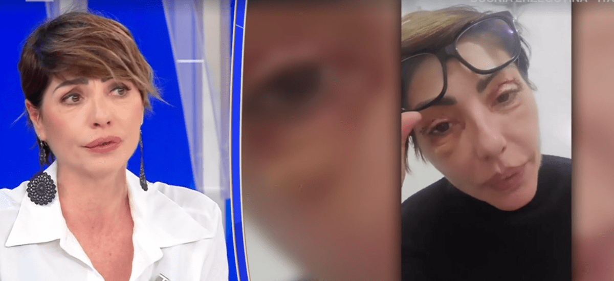 Ilaria Galassi, insulti social per i ritocchi estetici: "Offese anche sui miei figli"