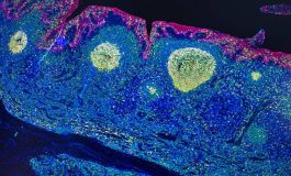 Irccs Pascale Napoli mappa Gps delle cellule rivoluziona limmunoterapia 265x160